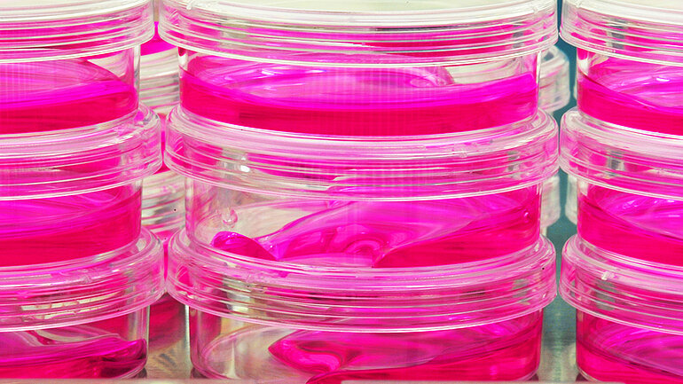 Übereinander gestapelte Petrischalen, gefüllt mit roter Masse